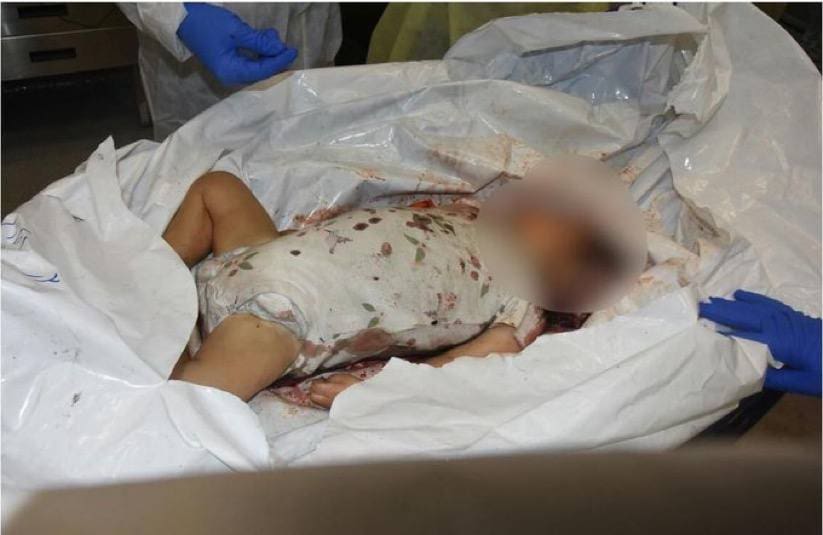 Baby slaughtered by Hamas